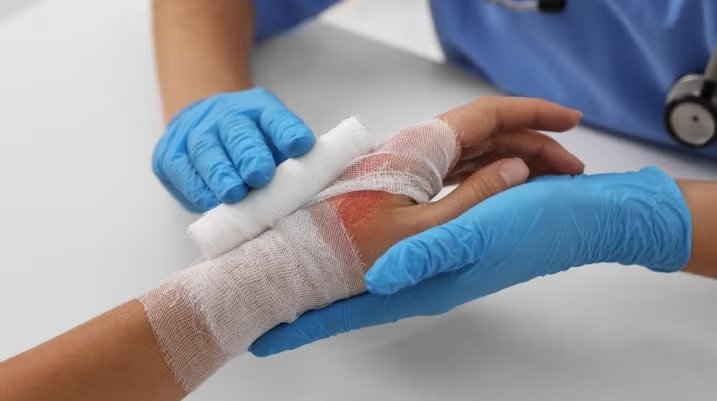 How to Sue for Burn Injuries in Kansas: A Step-by-Step Legal Guide